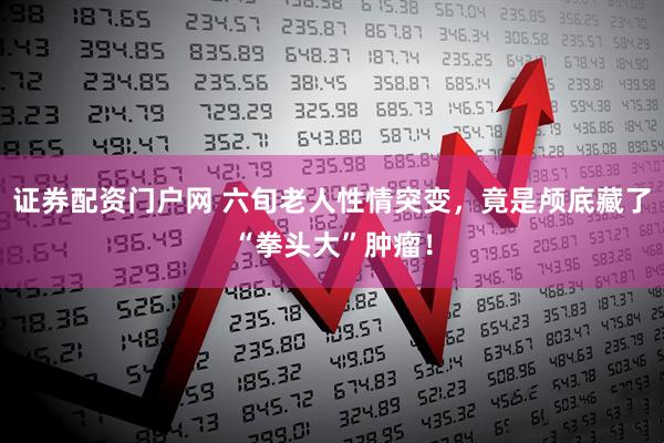 证券配资门户网 六旬老人性情突变，竟是颅底藏了“拳头大”肿瘤！
